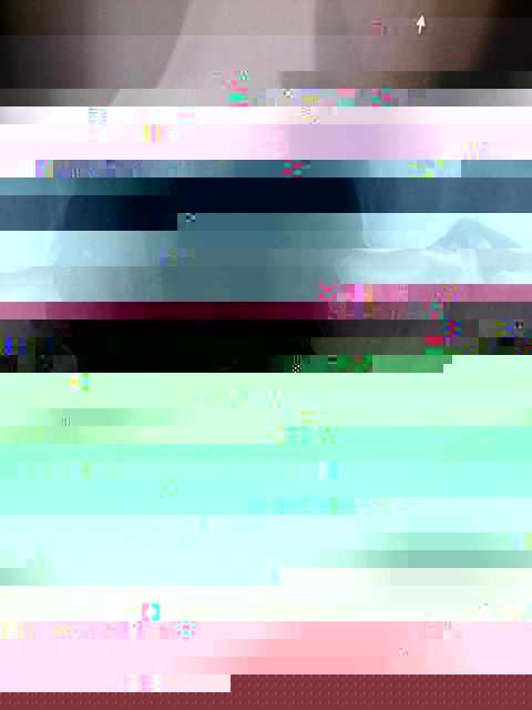 Before.jpg